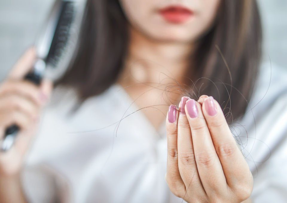 hair fall in children with cerebral palsy