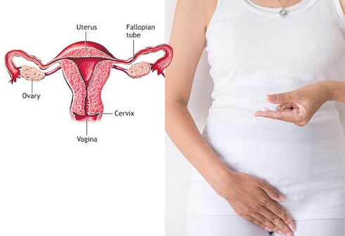 Leucorrhoea