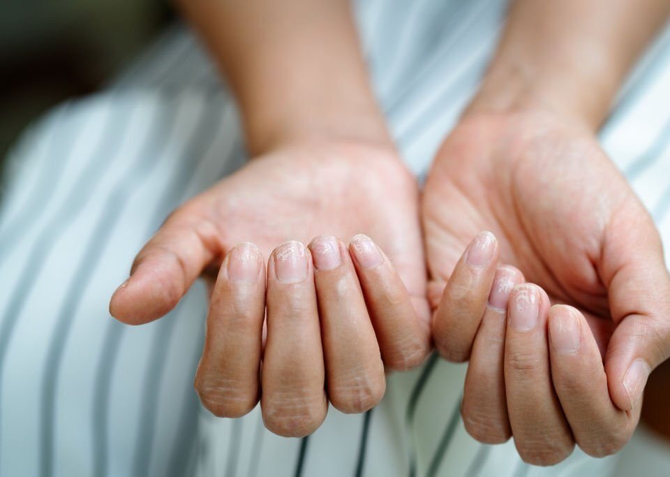 Nail Diseases And Homeopathy