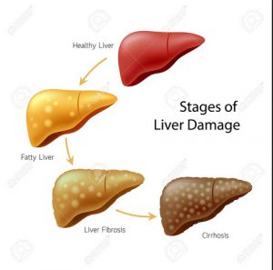 stages of liver